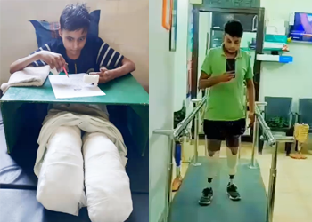 Rakeshbeforeafter