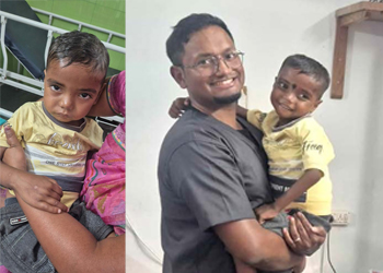 PJCH Vivek before & after rect